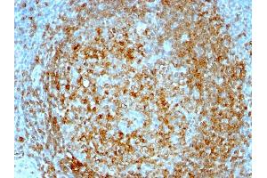 Formalin-fixed, paraffin-embedded human Tonsil stained with CD74 Mouse Monoclonal Antibody (CLIP/813). (CD74 antibody)
