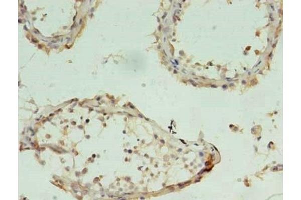 CHAC1 antibody  (AA 43-264)