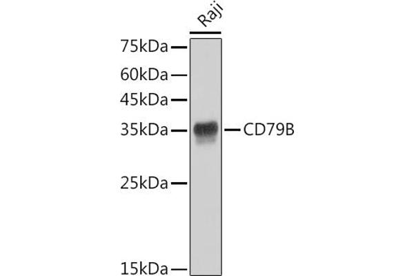 CD79b antibody