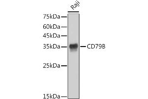 Western blot analysis of extracts of Raji cells, using CD79B antibody (ABIN1682474, ABIN3018855, ABIN3018856 and ABIN7101674) at 1:1000 dilution. (CD79b antibody)