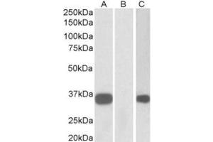 Western Blotting (WB) image for anti-Kv Channel Interacting Protein 3, Calsenilin (KCNIP3) (N-Term) antibody (ABIN2465094) (DREAM antibody  (N-Term))