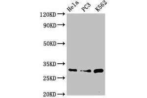Western Blot Positive WB detected in: Hela whole cell lysate, PC-3 whole cell lysate, K562 whole cell lysate All lanes: PSMA1 antibody at 3. (PSMA1 antibody  (AA 163-263))