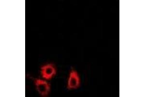 Immunofluorescence (IF) image for anti-SET and MYND Domain Containing 4 (SMYD4) (AA 1-260) antibody (ABIN5936313) (SMYD4 antibody  (AA 1-260))