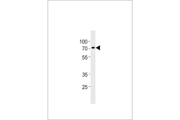 ST7L antibody  (C-Term)