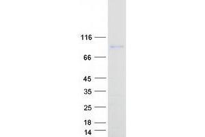 CCDC62 Protein (Coiled coil domain, Transcript Variant 1) (Myc-DYKDDDDK Tag)