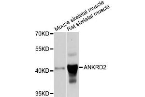 Western blot analysis of extracts of mouse skeletal muscle and rat skeletal muscle cells, using ANKRD2 antibody. (ANKRD2 antibody)