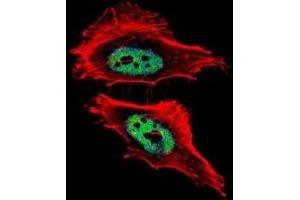 Fluorescent confocal image of HeLa cells stained with CTBP1 antibody. (CTBP1 antibody  (AA 413-440))