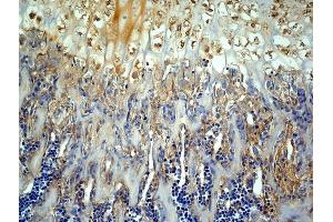 Generously provided by Markus Linder from Medical University Vienna as part of the Bioss Discovery Program. (MMP13 antibody  (AA 201-300))