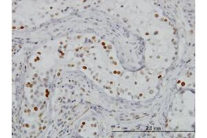 Immunoperoxidase of monoclonal antibody to BRD3 on formalin-fixed paraffin-embedded human testis. (BRD3 antibody  (AA 418-556))