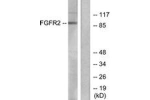 Western blot analysis of extracts from A549 cells, using FGFR2 Antibody. (FGFR2 antibody  (AA 471-520))