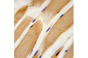 Image no. 3 for anti-Actin, Alpha, Cardiac Muscle 1 (ACTC1) (Center) antibody (ABIN357023) (ACTC1 antibody  (Center))