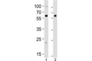 Western blot analysis of lysate from 1) human 293 and 2) mouse NIH3T3 cell line using BMPR1A antibody at 1:1000.