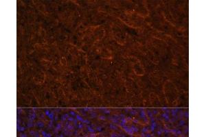 Immunofluorescence analysis of Human spleen using ICOS Polyclonal Antibody at dilution of 1:100. (ICOS antibody)