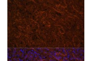 Immunofluorescence analysis of Human spleen using ICOS Polyclonal Antibody at dilution of 1:100. (ICOS antibody)