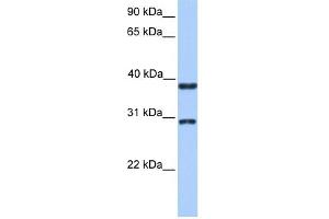 KLHDC1 antibody used at 1 ug/ml to detect target protein. (KLHDC1 antibody  (N-Term))