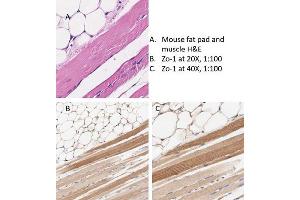 Immunohistochemistry (IHC) image for anti-Tight Junction Protein 1 (TJP1) antibody (ABIN6655950)