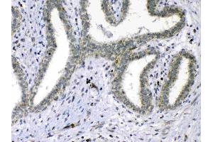IHC analysis of Cdc20 using anti-Cdc20 antibody . (CDC20 antibody)