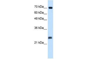 Human Placenta; WB Suggested Anti-SERTAD1 Antibody Titration: 0.