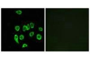 Immunofluorescence analysis of A549 cells, using MRPL32 antibody.