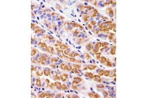 Immunohistochemical analysis of paraffin-embedded H. (VAMP8 antibody  (N-Term))