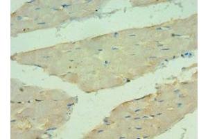 Immunohistochemistry of paraffin-embedded human skeletal muscle tissue using ABIN7144121 at dilution of 1:100 (ANGPTL4 antibody  (AA 26-406))