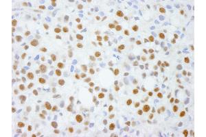 Immunohistochemistry (IHC) image for anti-Activity-Dependent Neuroprotector Homeobox (ADNP) (C-Term) antibody (ABIN7448403) (ADNP antibody  (C-Term))