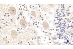 Detection of GSTM2 in Human Cerebellum Tissue using Polyclonal Antibody to Glutathione S Transferase Mu 2 (GSTM2) (GSTM2 antibody  (AA 3-218))