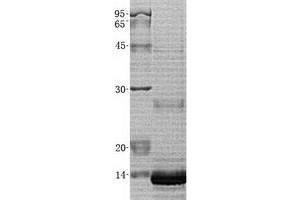 Validation with Western Blot (ZBED1 Protein (Transcript Variant 3) (His tag))