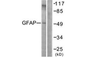 Western blot analysis of extracts from COLO205 cells, using GFAP (Ab-38) Antibody. (GFAP antibody  (AA 11-60))