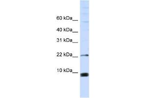 WB Suggested Anti-SNRPF Antibody Titration:  0. (SNRPF antibody  (Middle Region))