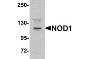 Western blot analysis of NOD1 in EL4 cell lysate with NOD1 antibody at 1 μg/ml. (NOD1 antibody  (C-Term))