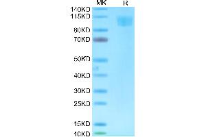 Biotinylated Cynomolgus ACE2 on Tris-Bis PAGE under reduced condition. (ACE2 Protein (His-Avi Tag,Biotin))