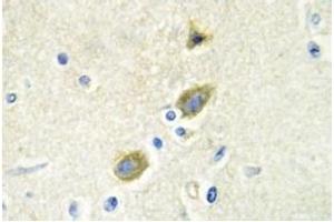 Image no. 2 for anti-Growth Arrest-Specific 6 (GAS6) antibody (ABIN317613) (GAS6 antibody)