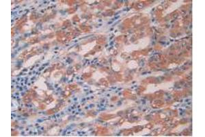IHC-P analysis of Human Stomach Tissue, with DAB staining. (IL-15 antibody  (AA 50-162))