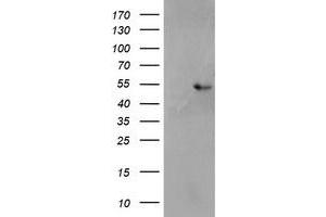 HEK293T cells were transfected with the pCMV6-ENTRY control (Left lane) or pCMV6-ENTRY SH2D2A (Right lane) cDNA for 48 hrs and lysed. (SH2D2A antibody)