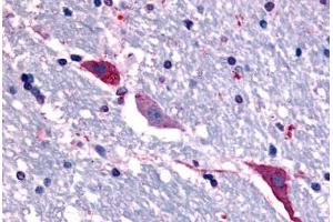 Anti-TACR3 antibody  ABIN1049392 IHC staining of human brain, hippocampus. (TACR3 antibody  (C-Term))