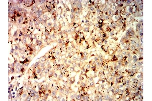 Glypican 3 antibody  (AA 55-200)