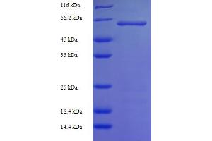 SDS-PAGE (SDS) image for serine/threonine Kinase 25 (STK25) (AA 1-426), (full length) protein (His-SUMO Tag) (ABIN4975778) (STK25 Protein (AA 1-426, full length) (His-SUMO Tag))