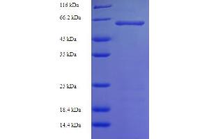 SDS-PAGE (SDS) image for serine/threonine Kinase 25 (STK25) (AA 1-426), (full length) protein (His-SUMO Tag) (ABIN5710428)