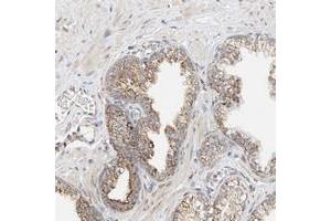 Immunohistochemical staining of human prostate with YIPF7 polyclonal antibody  shows moderate cytoplasmic positivity with a granular pattern in glandular cells.