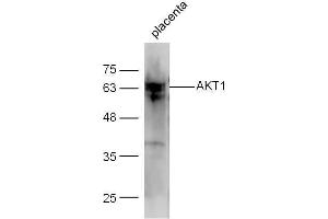 Mouse placenta lysate with Anti-AKT1/3 Polyclonal Antibody Unconjugated  at 1:5000 for 90 min at 37˚C. (AKT 1/2/3 antibody  (AA 401-479))