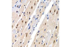 Immunohistochemistry of paraffin-embedded rat heart using MT2A antibody at dilution of 1:200 (400x lens). (MT2A antibody)
