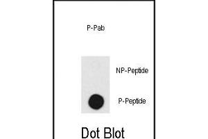 Dot blot analysis of anti-DNA-PK-p Pab (R) on nitrocellulose membrane.