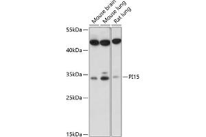 Western blot analysis of extracts of various cell lines, using PI15 antibody (ABIN7269205) at 1:1000 dilution. (PI15 antibody  (AA 61-170))