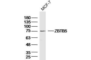 MCF-7 Cell lysates probed with ZBTB5 Polyclonal Antibody, unconjugated  at 1:300 overnight at 4°C followed by a conjugated secondary antibody for 60 minutes at 37°C.