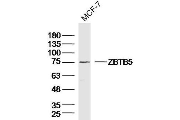 ZBTB5 anticorps  (AA 581-677)