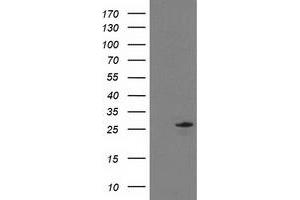 HEK293T cells were transfected with the pCMV6-ENTRY control (Left lane) or pCMV6-ENTRY C1orf50 (Right lane) cDNA for 48 hrs and lysed. (C1ORF50 antibody)