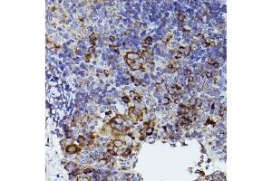 Immunohistochemistry of paraffin-embedded mouse spleen using THBS1 Rabbit pAb (ABIN3022978, ABIN3022979, ABIN3022980 and ABIN6219329) at dilution of 1:50 (40x lens). (Thrombospondin 1 antibody  (AA 80-360))