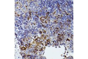 Immunohistochemistry of paraffin-embedded mouse spleen using THBS1 Rabbit pAb (ABIN3022978, ABIN3022979, ABIN3022980 and ABIN6219329) at dilution of 1:50 (40x lens). (Thrombospondin 1 antibody  (AA 80-360))