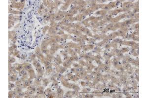 Immunoperoxidase of monoclonal antibody to CBS on formalin-fixed paraffin-embedded human liver. (CBS antibody  (AA 1-100))